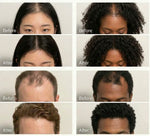 Korean Scalp Revival Bar